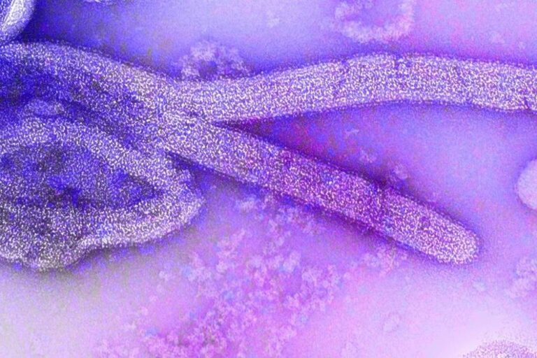 Epidemia do vírus marburgo é confirmada na Etiópia