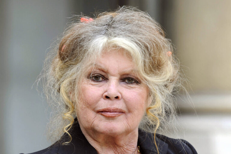 Brigitte Bardot está internada em estado grave e fez cirurgia de emergência