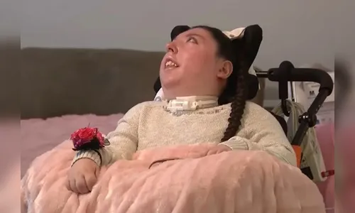 Jovem que nasceu sem cérebro celebra 20 anos nos EUA