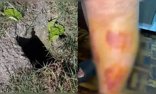 Moradora de Curitiba se fere ao cair em bueiro sem tampa
