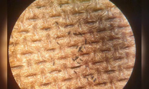 Arapongas registra 1.411 casos de dengue e sete de chikungunya
