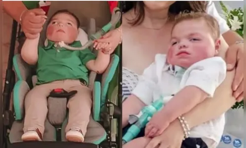 Menino de cinco anos falece após lutar contra doença rara no Paraná