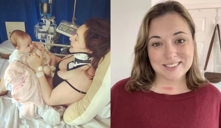 Mulher quebra pescoço ao bocejar pela manhã