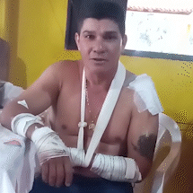 Confusão na BR-419: Motociclista alega ataque de onça, polícia aponta atropelamento de jaguatirica