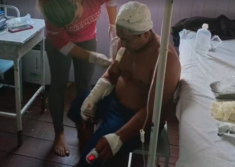 Sobrevivência na Amazônia: Cacique Escapa Ileso de Ataque de Onça; Vídeo Choca Comunidade