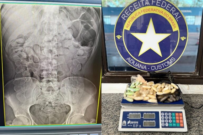Homem preso com 90 cápsulas de droga no estômago durante operação