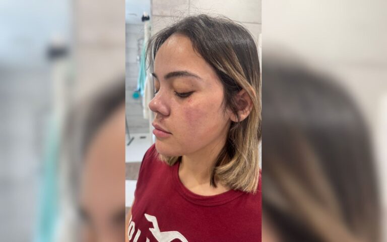 Brasileira traumatizada após tentativa de estupro em metrô de Paris
