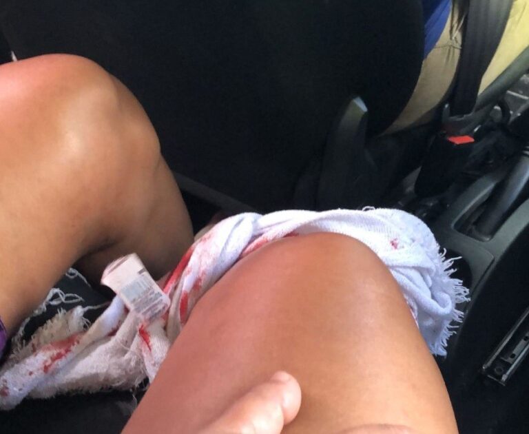 Grávida baleada durante tiroteio passa por parto de emergência